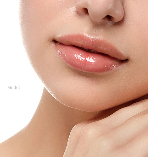 Lip Fillers