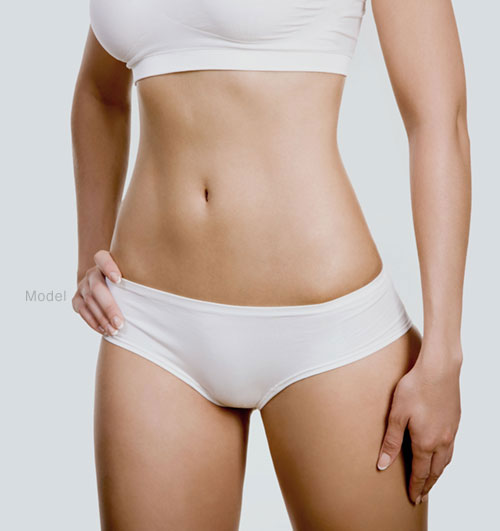 Liposuction for Definition
